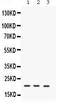 Interleukin 7 antibody, PB9871, Boster Biological Technology, Western Blot image 