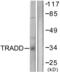 TNFRSF1A Associated Via Death Domain antibody, LS-B8395, Lifespan Biosciences, Western Blot image 