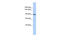 TNNI3 Interacting Kinase antibody, ARP48045_P050, Aviva Systems Biology, Western Blot image 