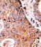 Lemur Tyrosine Kinase 2 antibody, AP13771PU-N, Origene, Immunohistochemistry frozen image 