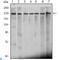 Chromodomain Helicase DNA Binding Protein 3 antibody, LS-C814027, Lifespan Biosciences, Western Blot image 