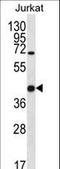 L-36 lactose-binding protein antibody, LS-C165751, Lifespan Biosciences, Western Blot image 