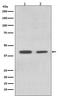 Acyl-CoA Dehydrogenase Medium Chain antibody, M02383, Boster Biological Technology, Western Blot image 