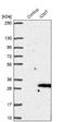 Isoprenylcysteine Carboxyl Methyltransferase antibody, NBP1-91795, Novus Biologicals, Western Blot image 