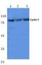 Cyclin F antibody, PA5-36049, Invitrogen Antibodies, Western Blot image 