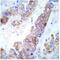 SLK antibody, GTX79071, GeneTex, Immunohistochemistry paraffin image 