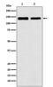 Ubiquitination Factor E4B antibody, M04338, Boster Biological Technology, Western Blot image 