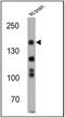 Nitric Oxide Synthase 1 antibody, PA1-033, Invitrogen Antibodies, Western Blot image 