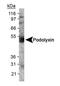Podocalyxin Like antibody, PA1-46169, Invitrogen Antibodies, Western Blot image 