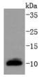 Dynein Light Chain LC8-Type 1 antibody, A03454-1, Boster Biological Technology, Western Blot image 