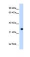 MAX Dimerization Protein MLX antibody, orb329723, Biorbyt, Western Blot image 