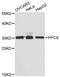 Phosphopantothenoylcysteine Synthetase antibody, A12828, ABclonal Technology, Western Blot image 