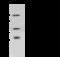 Clathrin Heavy Chain antibody, 104503-T40, Sino Biological, Western Blot image 