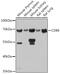 CD86 antibody, GTX32507, GeneTex, Western Blot image 