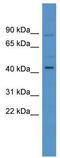 Zinc Finger Protein 540 antibody, TA341493, Origene, Western Blot image 