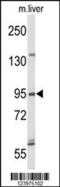 GEN1 Holliday Junction 5' Flap Endonuclease antibody, 63-976, ProSci, Western Blot image 