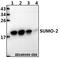 Small Ubiquitin Like Modifier 2 antibody, GTX66829, GeneTex, Western Blot image 
