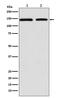 DNA Polymerase Gamma, Catalytic Subunit antibody, M02796, Boster Biological Technology, Western Blot image 