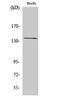 Adhesion G Protein-Coupled Receptor G6 antibody, PA5-50974, Invitrogen Antibodies, Western Blot image 