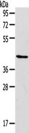 RUNX Family Transcription Factor 2 antibody, TA321649, Origene, Western Blot image 