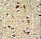 Cyclin Dependent Kinase 19 antibody, LS-C168589, Lifespan Biosciences, Immunohistochemistry frozen image 