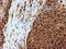 Proteasome Subunit Beta 9 antibody, M02867-1, Boster Biological Technology, Immunohistochemistry paraffin image 