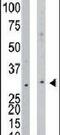 N-Acetylglucosamine Kinase antibody, PA5-13843, Invitrogen Antibodies, Western Blot image 