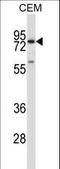 Matrix metalloproteinase-16 antibody, LS-C164238, Lifespan Biosciences, Western Blot image 