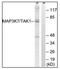 Mitogen-Activated Protein Kinase Kinase Kinase 7 antibody, AP31342PU-N, Origene, Western Blot image 