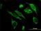 Heat Shock Protein Family E (Hsp10) Member 1 antibody, H00003336-M01, Novus Biologicals, Immunofluorescence image 