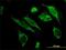 10 kDa heat shock protein, mitochondrial antibody, H00003336-M01, Novus Biologicals, Immunofluorescence image 