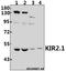 Potassium Voltage-Gated Channel Subfamily J Member 2 antibody, A01850-1, Boster Biological Technology, Western Blot image 
