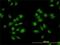 BRX antibody, H00011214-M01, Novus Biologicals, Immunocytochemistry image 