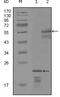 Erb-B2 Receptor Tyrosine Kinase 3 antibody, MA5-15437, Invitrogen Antibodies, Western Blot image 