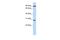 Boule Homolog, RNA Binding Protein antibody, PA5-41922, Invitrogen Antibodies, Western Blot image 