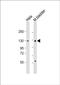 Ectonucleotide Pyrophosphatase/Phosphodiesterase 1 antibody, PA5-72141, Invitrogen Antibodies, Western Blot image 