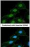 Calcium/calmodulin-dependent protein kinase type 1 antibody, PA5-28355, Invitrogen Antibodies, Immunofluorescence image 