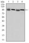 Eukaryotic Translation Elongation Factor 2 antibody, GTX60421, GeneTex, Western Blot image 