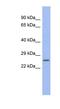 Zinc And Ring Finger 1 antibody, NBP1-80377, Novus Biologicals, Western Blot image 