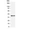 Protein Phosphatase 2 Catalytic Subunit Alpha antibody, R30249, NSJ Bioreagents, Western Blot image 