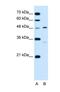 Carbohydrate Sulfotransferase 1 antibody, NBP1-62542, Novus Biologicals, Western Blot image 