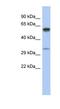 Zinc Finger DHHC-Type Containing 24 antibody, NBP1-62198, Novus Biologicals, Western Blot image 