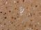 MDM2 Binding Protein antibody, MBS2524074, MyBioSource, Immunohistochemistry frozen image 