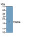 S100 Calcium Binding Protein A8 antibody, LS-C303278, Lifespan Biosciences, Western Blot image 