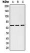 Selectin E antibody, orb215517, Biorbyt, Western Blot image 