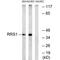Ribosome Biogenesis Regulator 1 Homolog antibody, PA5-50119, Invitrogen Antibodies, Western Blot image 