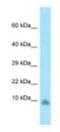 G Protein Subunit Gamma 13 antibody, NBP1-98572, Novus Biologicals, Western Blot image 