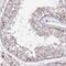Diphthamide Biosynthesis 2 antibody, NBP2-13933, Novus Biologicals, Immunohistochemistry paraffin image 