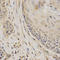 Serpin Family F Member 1 antibody, LS-C331628, Lifespan Biosciences, Immunohistochemistry frozen image 