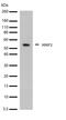 Matrix Metallopeptidase 3 antibody, 701285, Invitrogen Antibodies, Western Blot image 